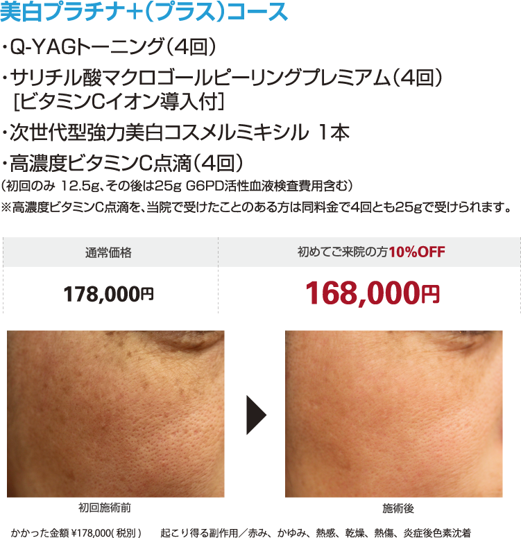 美白になる