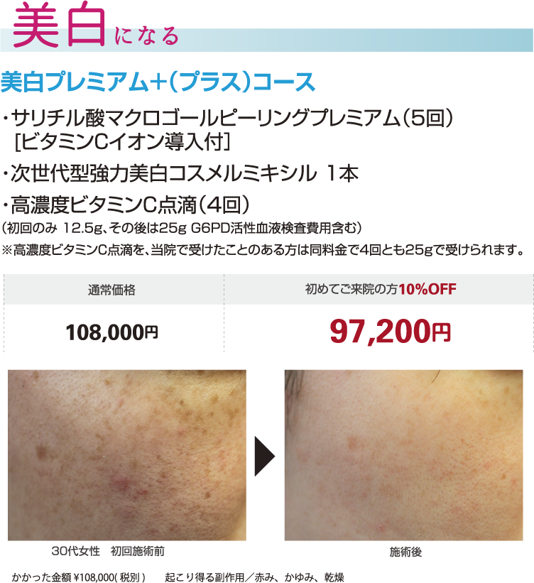 美白になる
