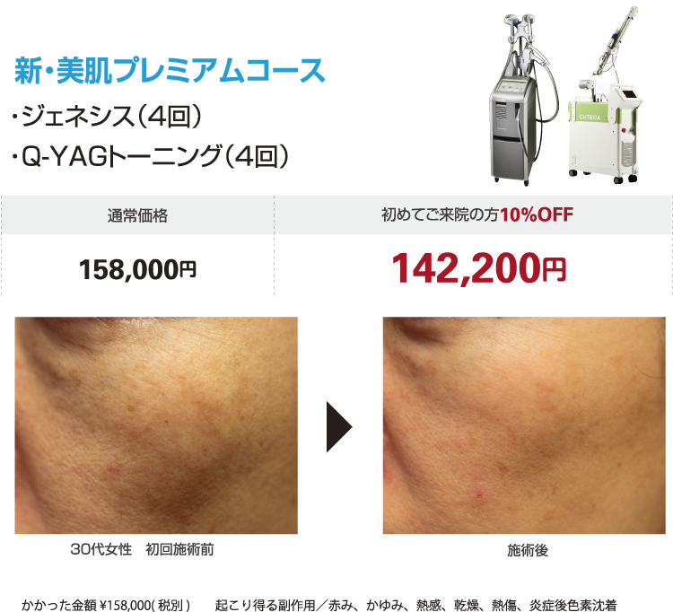 新美肌プレミアムコース