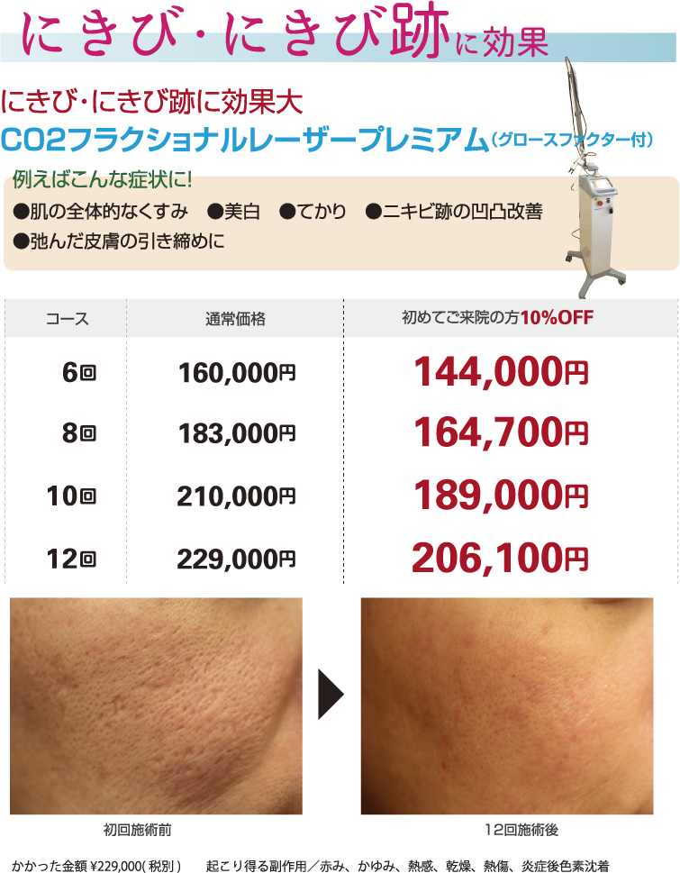 にきび・にきび跡に効果