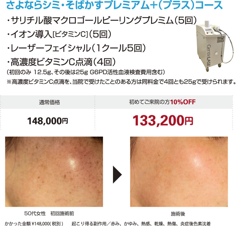 さよならシミ・そばかすプレミアムプラスコース
