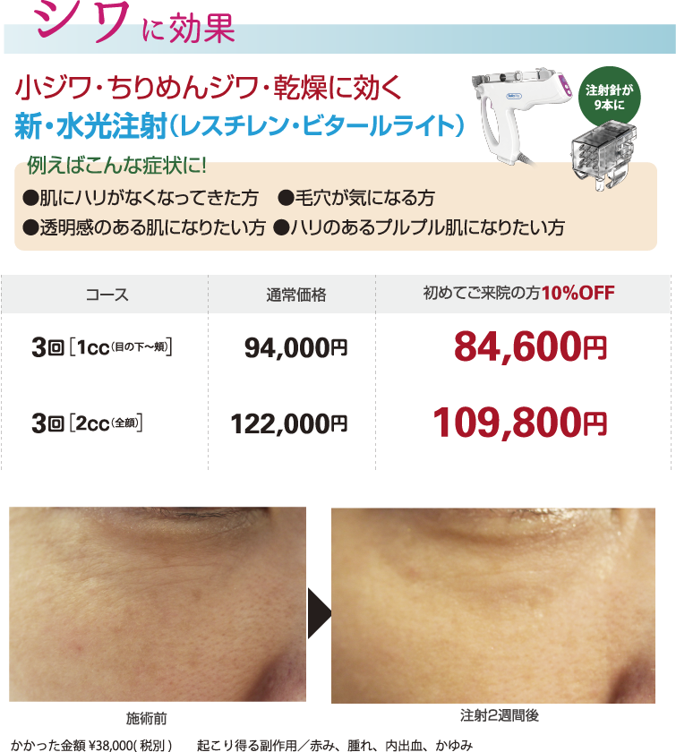 しわに効果